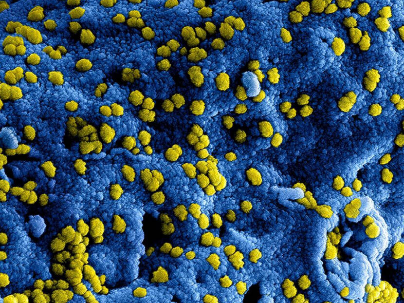 Microscopisch beeld van het coronavirus
